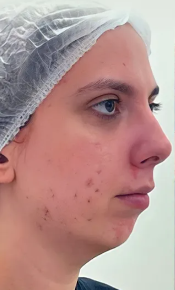 Antes do tratamento 1