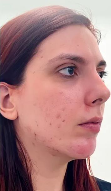 Depois do tratamento 1